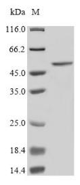 SDS-PAGE (ST6GAL1-2720H).jpg